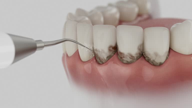 Reliable Emergency Dentist contractor in Forest, OH by Smile Center Dentistry